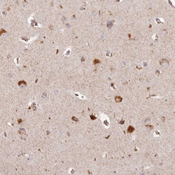 CHCHD2 Antibody, Novus Biologicals 0.1mL; Unlabeled:Antibodies, Polyclonal
